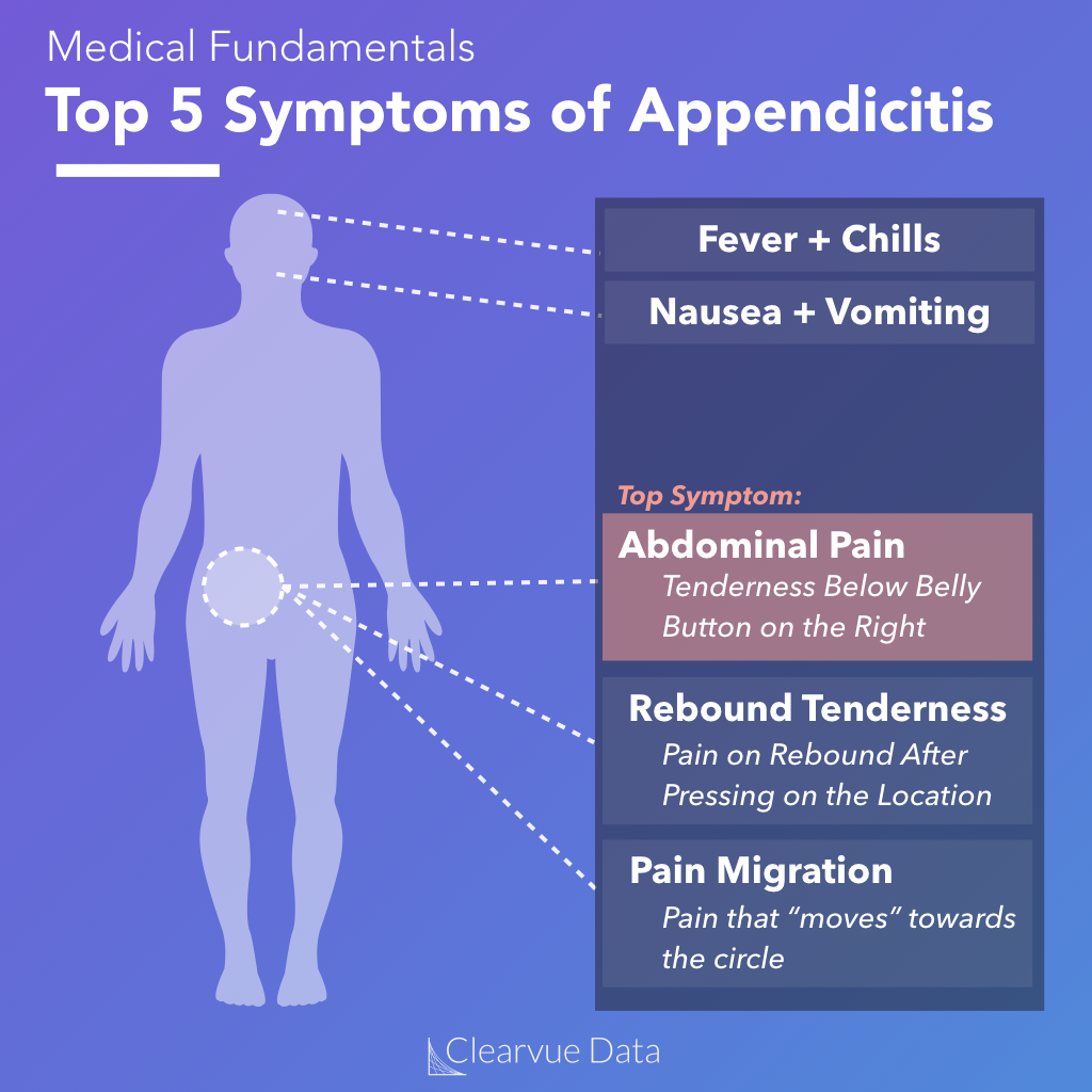 Top 5 Symptoms of Appendicitis