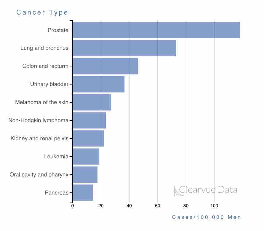 Top 10 Cancers in Men Chart