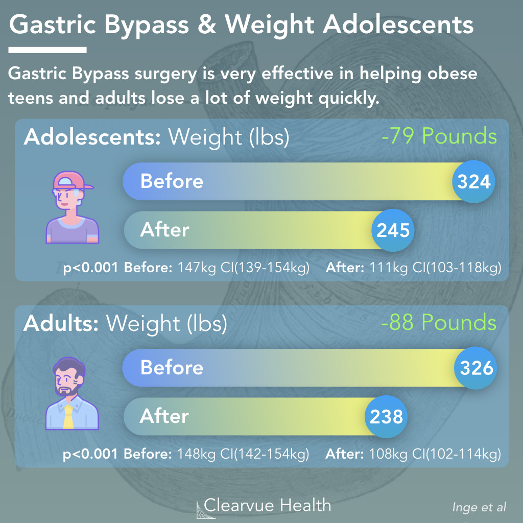 Bariatric Surgery Weight Loss Chart