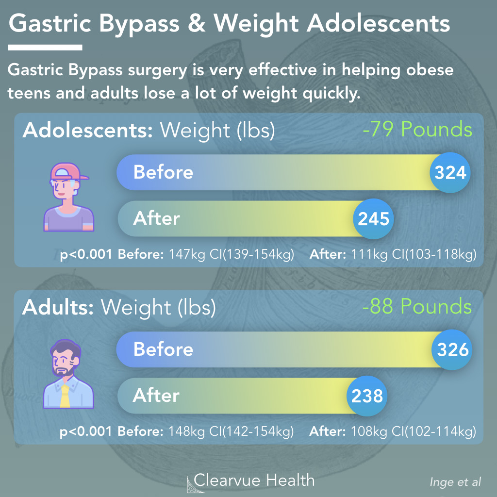 Gastric Bypass Surgery Weight Loss Chart