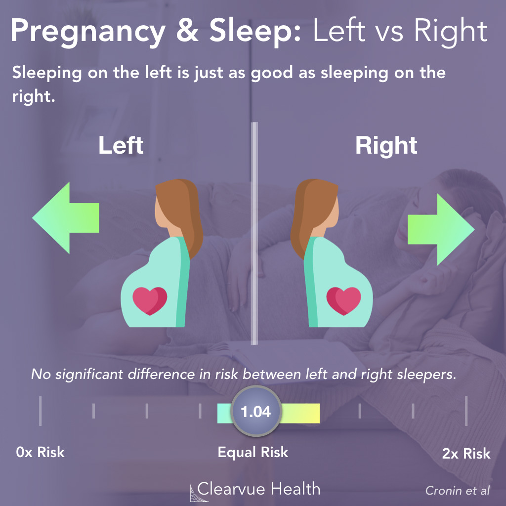 Sleeping on the left versus the right in pregnancy