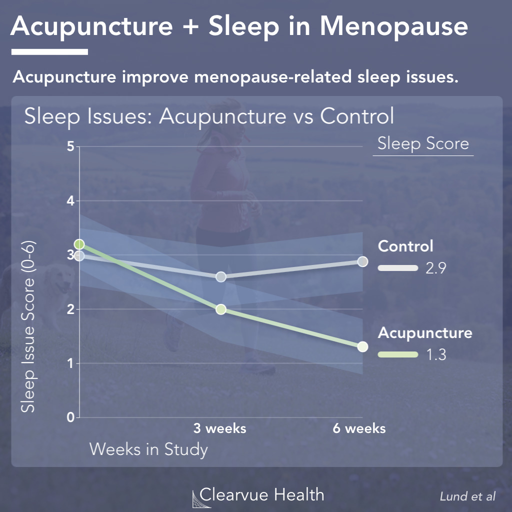 Acupuncture improves sleep symptoms