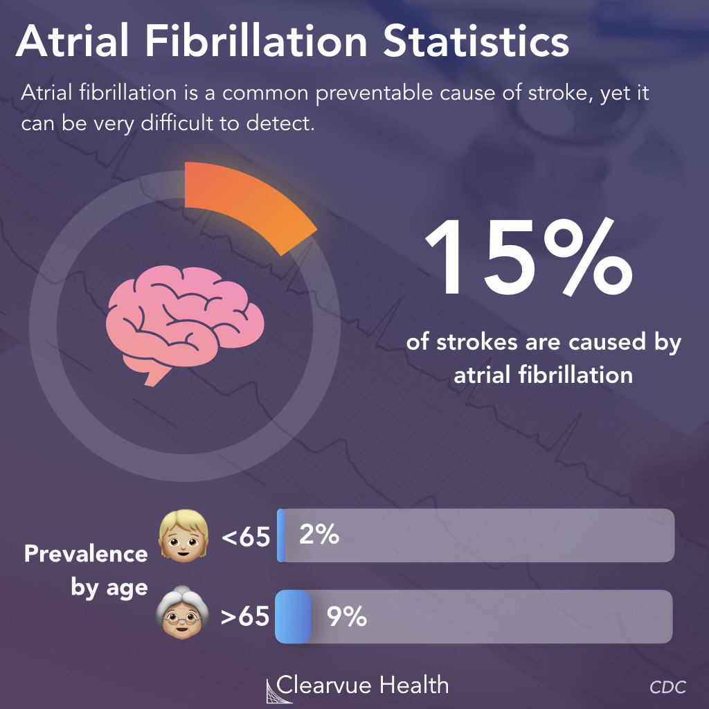 Atrial Fibrillation Statistics