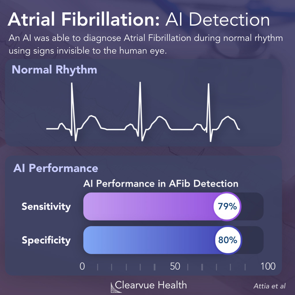 Detection of Atrial Fibrillation in Normal Sinus Rhythm
