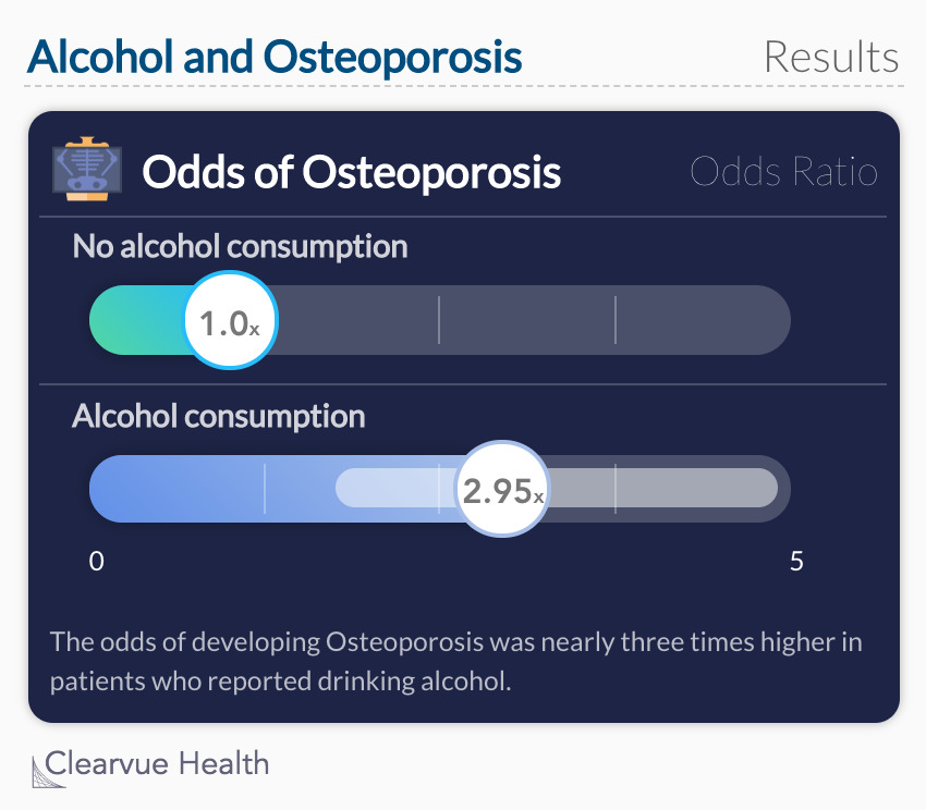 Alcohol and Osteoporosis: Alcohol and Osteoporosis