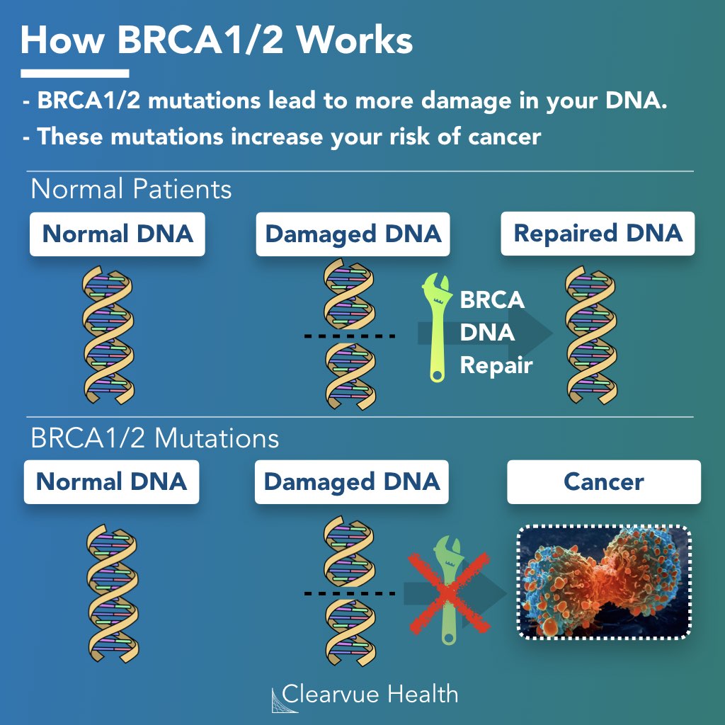 3 Charts Olaparib A New Hope For Brca Patients With Ovarian Cancer