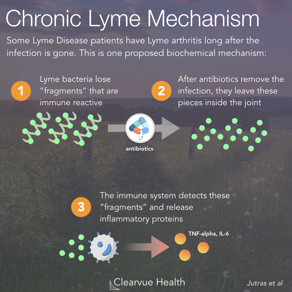 Chronic Lyme Disease Mechanism