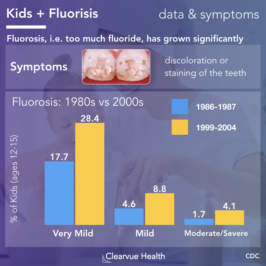 Fluorosis facts and statistics