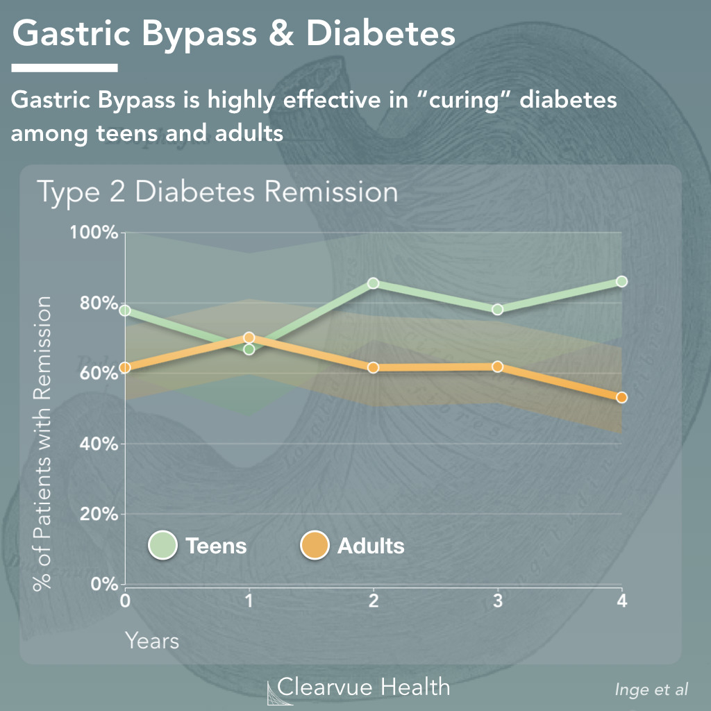 Gastric Bypass Surgery and Diabetes