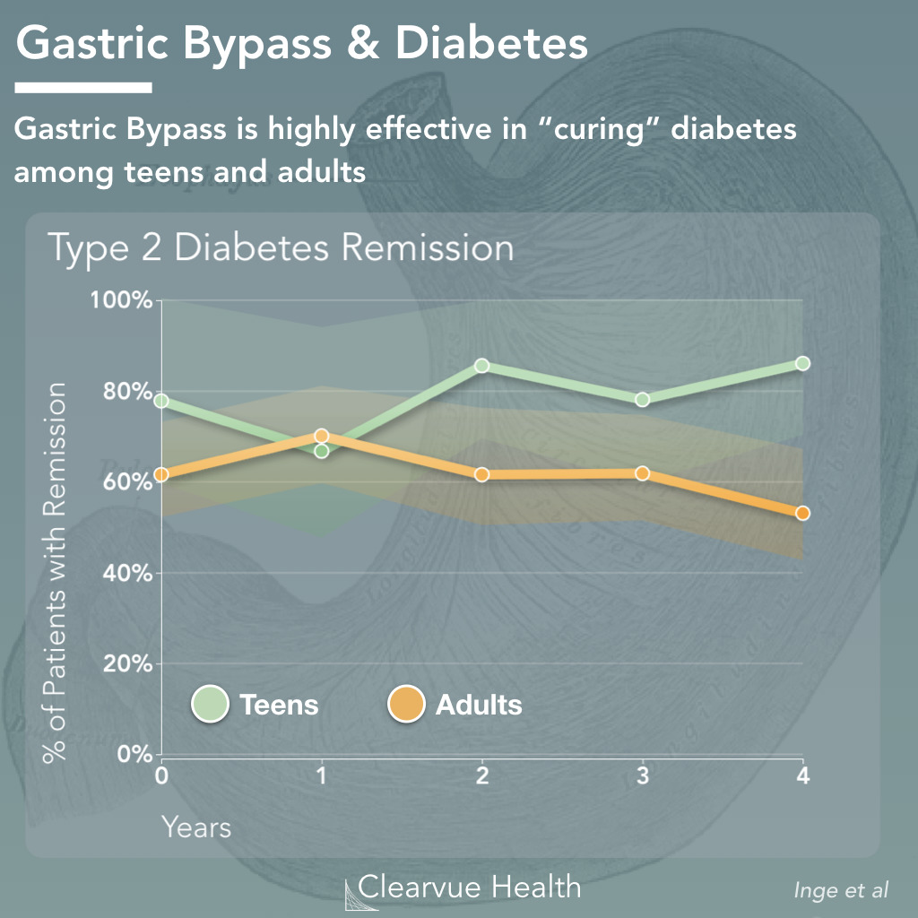 4 Charts Gastric Bypass Effectiveness In Adults And Teens