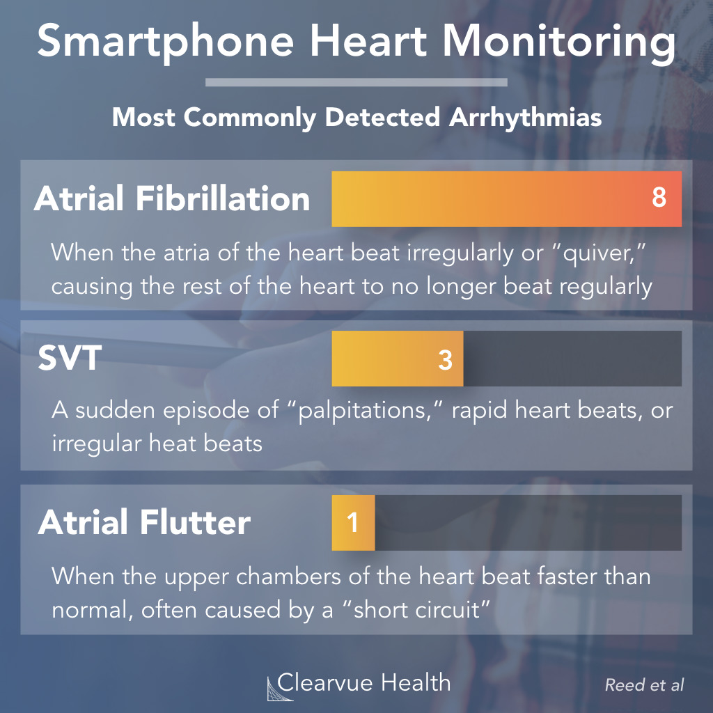 most common heart conditions caught on alivcor smartphone heart monitor