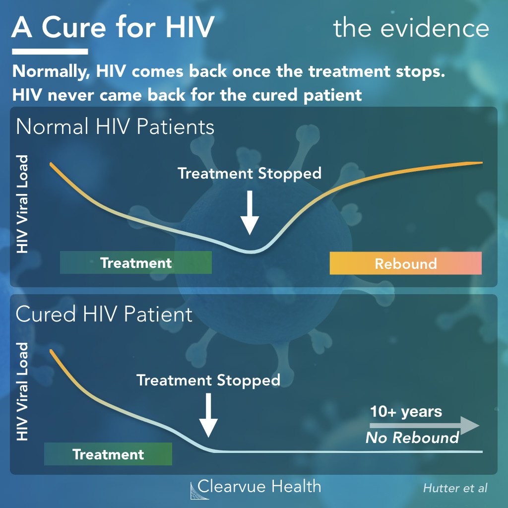 Effectiveness of Stem Cell Transplants in HIV