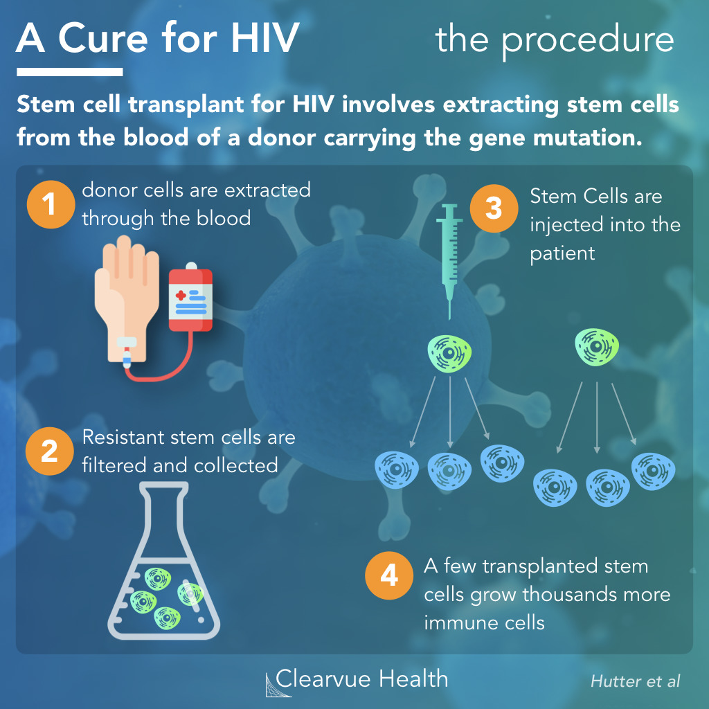 How HIV Stem Cell Cures Work