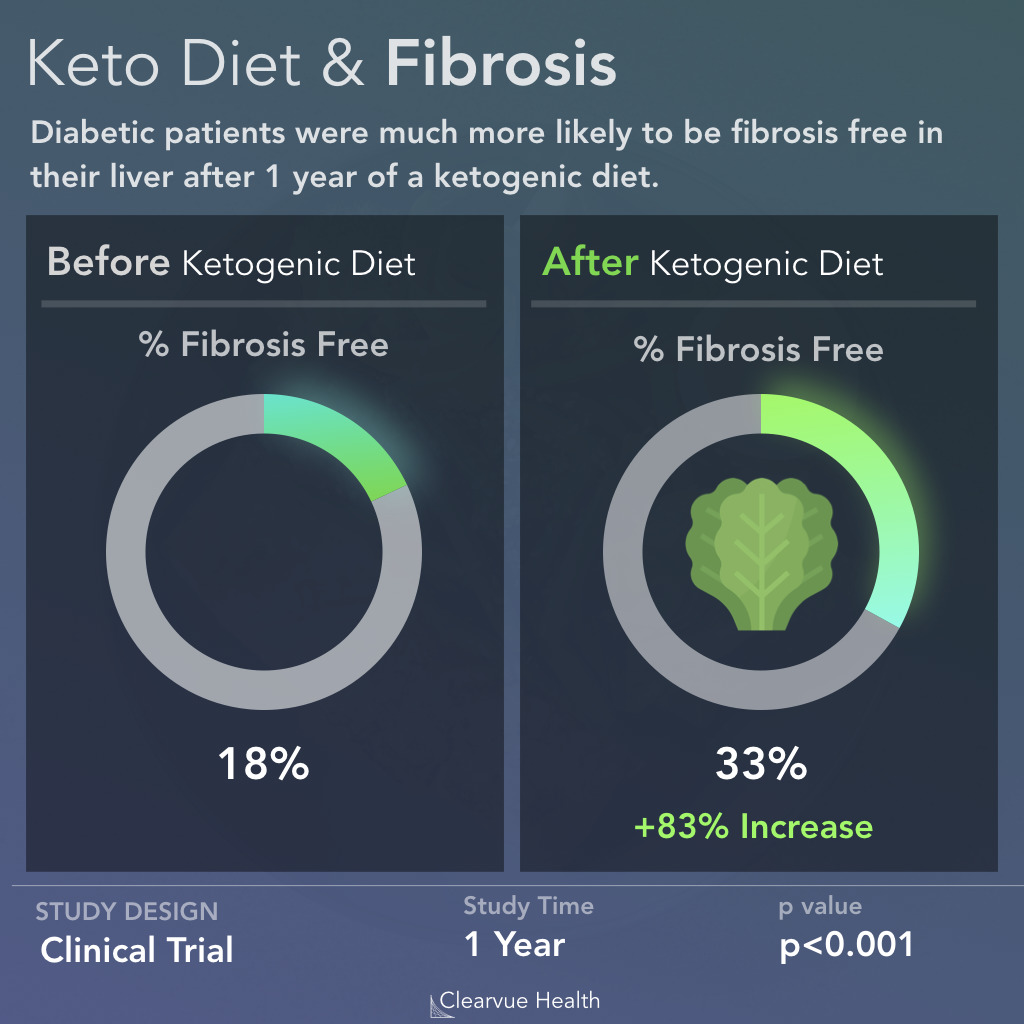 Keto & NASH (Advanced Fatty Liver Disease)