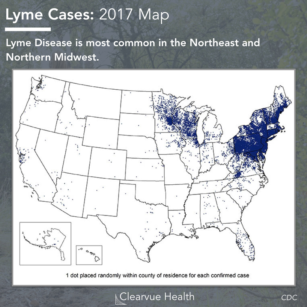 Lyme Disease Risk by Location