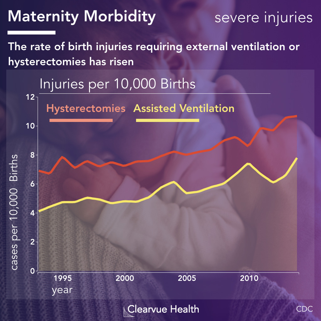 chart of hysterectomies and intubations in childbirth