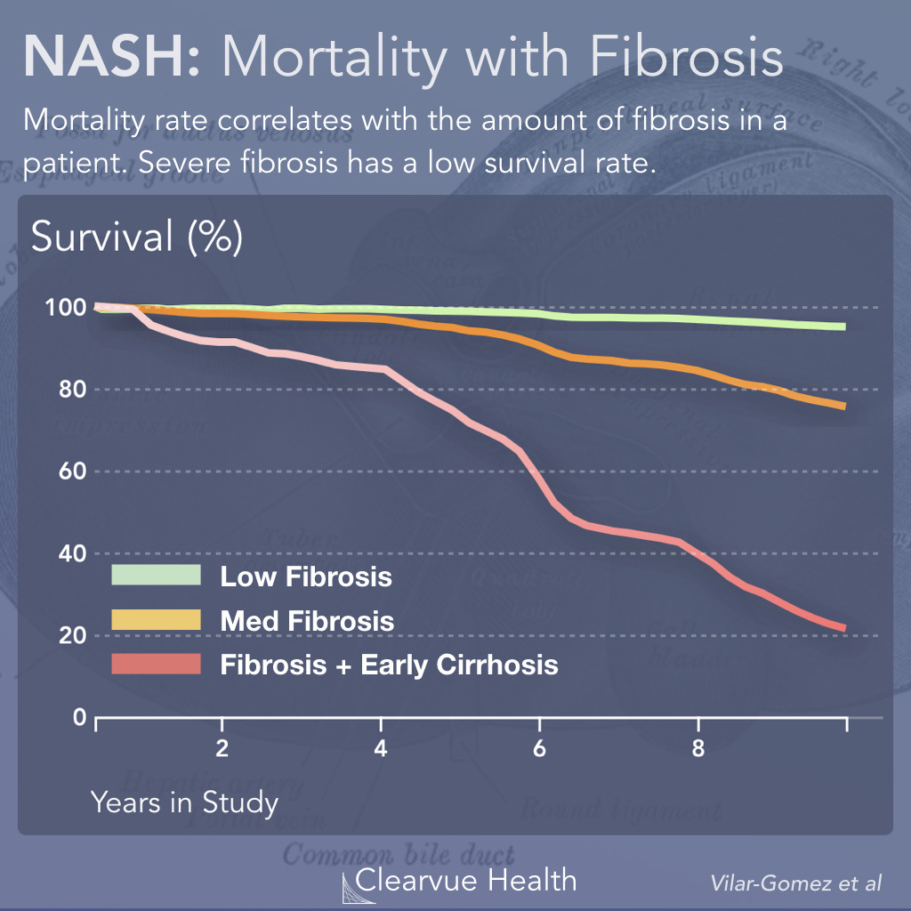 NASH mortality by stage