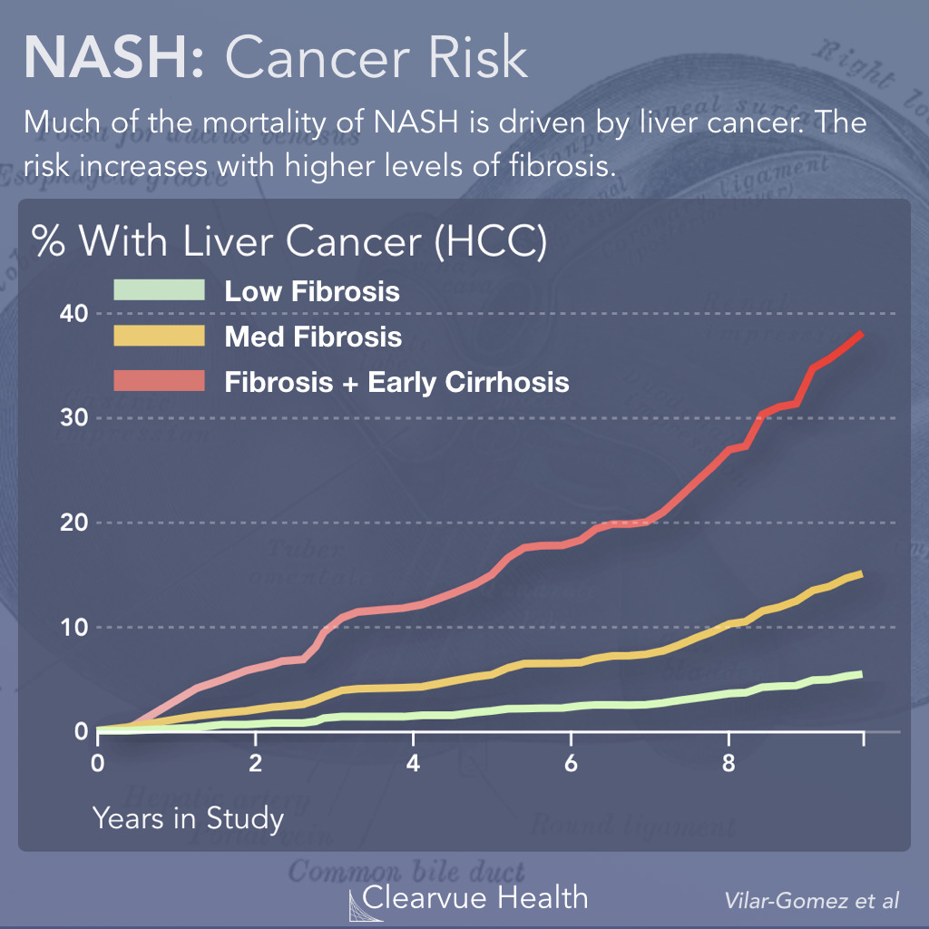  Liver Fibrosis and Cancer in NASH