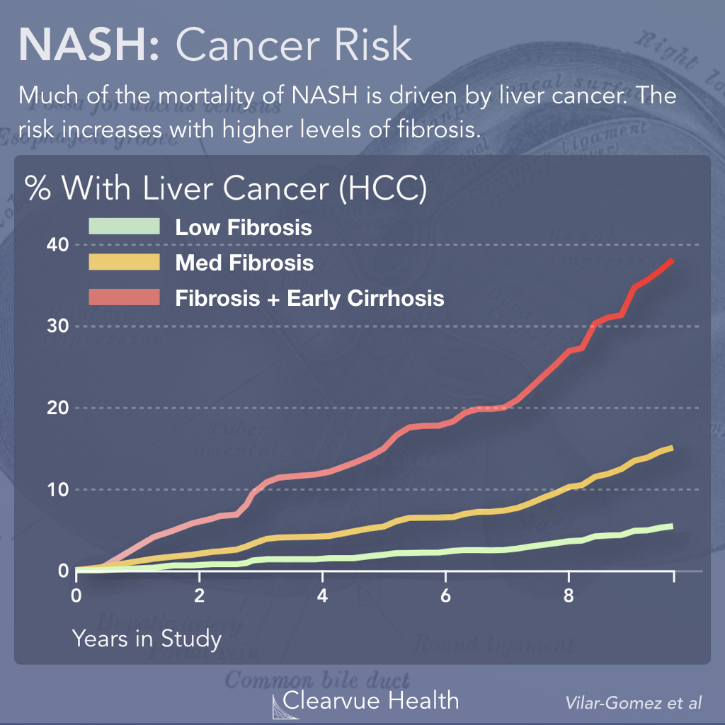 Liver Fibrosis and Cancer in NASH