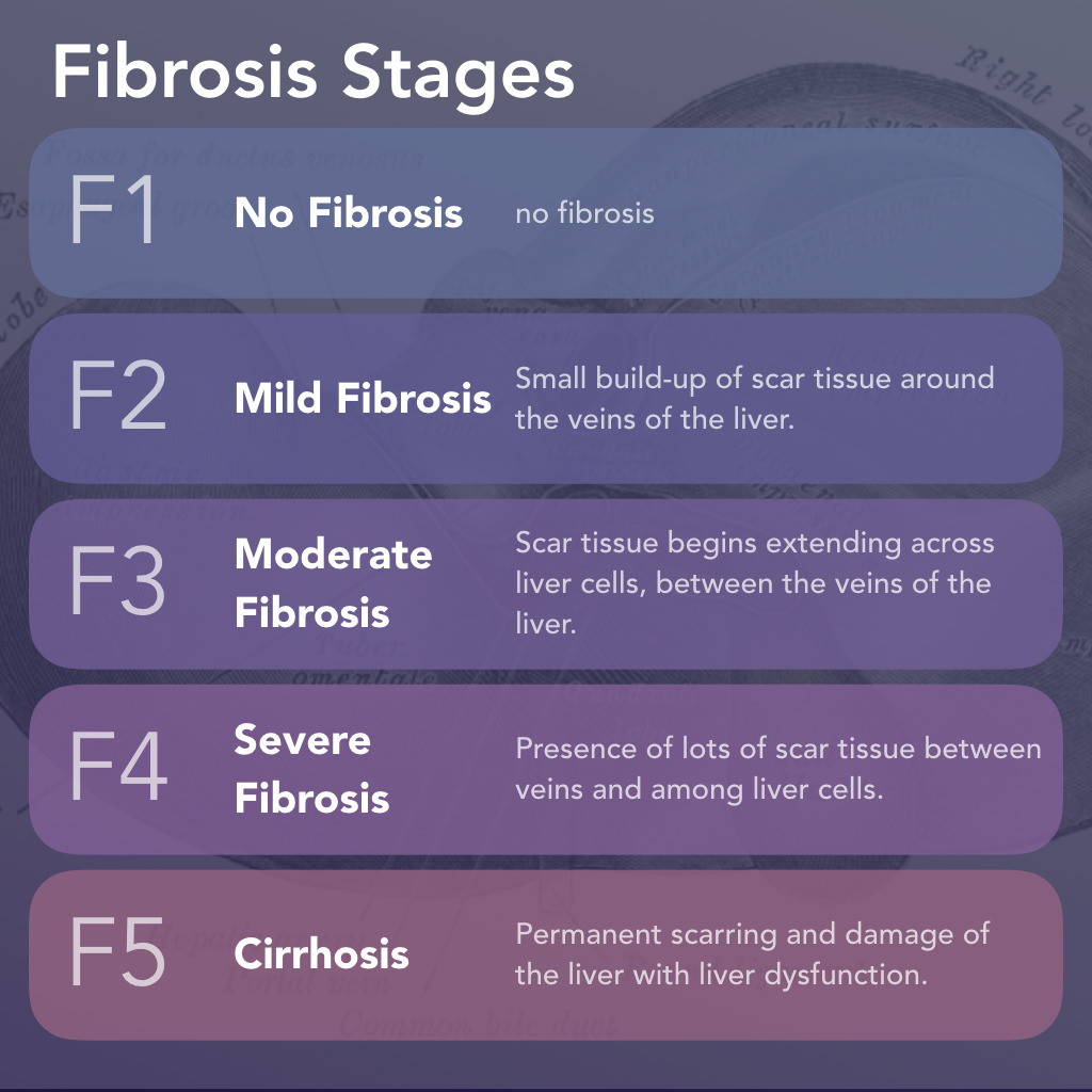 Liver Fibrosis Stages