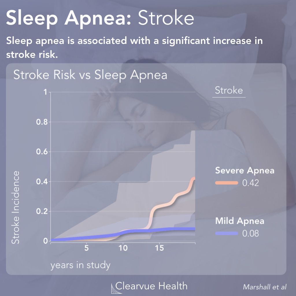Sleep Apnea and Stroke