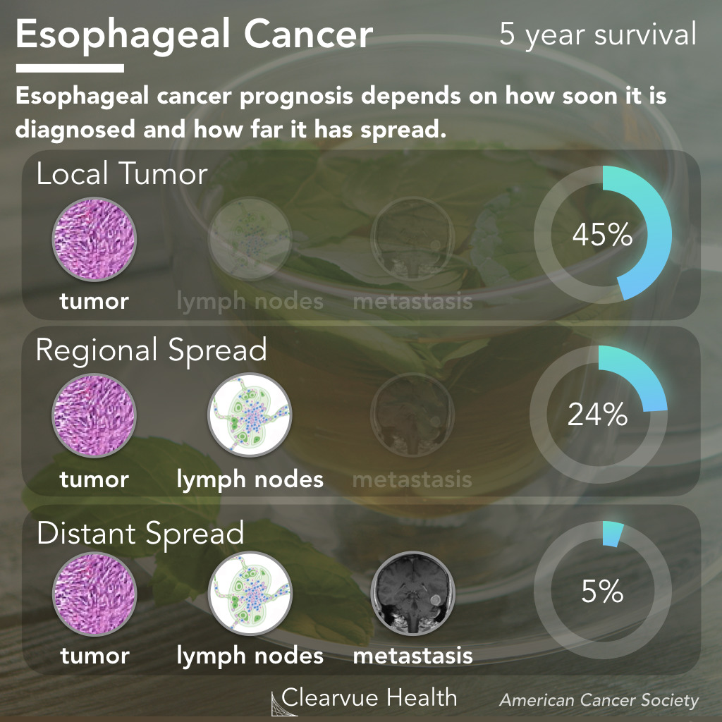 esophageal cancer prognosis