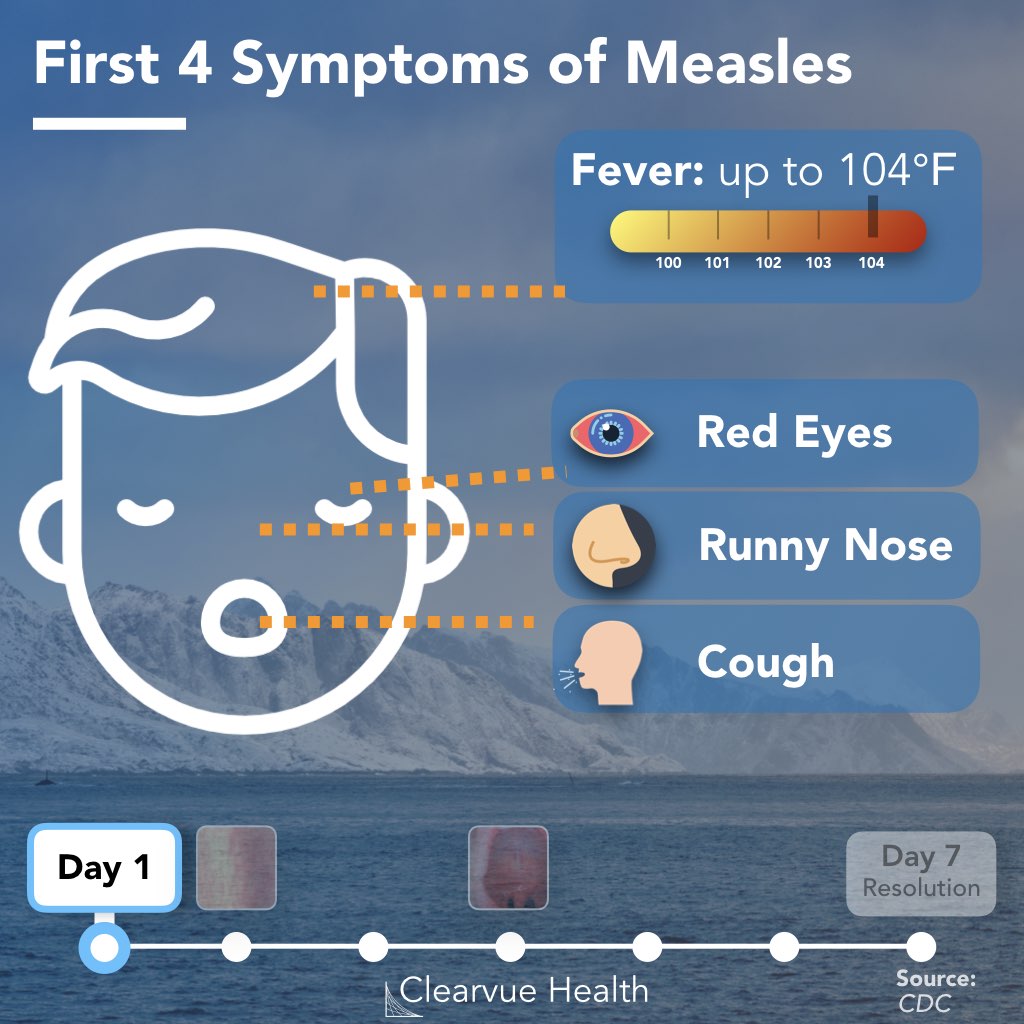 Early Symptoms of Measles